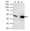 Ubiquinol-Cytochrome C Reductase Core Protein 2 antibody, NBP2-20816, Novus Biologicals, Immunoprecipitation image 