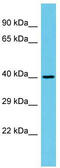 Nuclear Cap Binding Subunit 3 antibody, TA330682, Origene, Western Blot image 