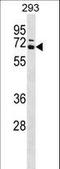 Coactivator Associated Arginine Methyltransferase 1 antibody, LS-C168317, Lifespan Biosciences, Western Blot image 