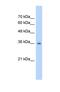 Ras Suppressor Protein 1 antibody, NBP1-54879, Novus Biologicals, Western Blot image 