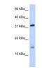 Eukaryotic translation initiation factor 1A, X-chromosomal antibody, NBP1-80556, Novus Biologicals, Western Blot image 