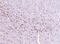 Secernin 1 antibody, A10002-1, Boster Biological Technology, Immunohistochemistry paraffin image 