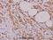 Proliferation And Apoptosis Adaptor Protein 15 antibody, A02988, Boster Biological Technology, Immunohistochemistry paraffin image 