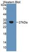 Alpha 1,4-Galactosyltransferase (P Blood Group) antibody, LS-C663212, Lifespan Biosciences, Western Blot image 