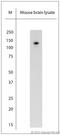 Transient Receptor Potential Cation Channel Subfamily C Member 6 antibody, LS-C95192, Lifespan Biosciences, Western Blot image 