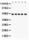 Abl Interactor 1 antibody, PB9416, Boster Biological Technology, Western Blot image 