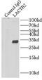 Lactamase Beta 2 antibody, FNab04673, FineTest, Immunoprecipitation image 