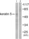 Keratin 5 antibody, abx013125, Abbexa, Western Blot image 