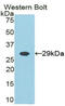 Growth Factor Receptor Bound Protein 2 antibody, MBS2004243, MyBioSource, Western Blot image 