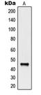Natural Cytotoxicity Triggering Receptor 1 antibody, LS-C353166, Lifespan Biosciences, Western Blot image 