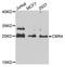 Carbonyl Reductase 4 antibody, A5069, ABclonal Technology, Western Blot image 