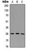Fibroblast Growth Factor 6 antibody, orb256536, Biorbyt, Western Blot image 