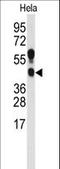 Protein Arginine Methyltransferase 1 antibody, LS-B3620, Lifespan Biosciences, Western Blot image 