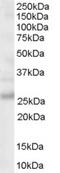 MYD88 Innate Immune Signal Transduction Adaptor antibody, orb18963, Biorbyt, Western Blot image 