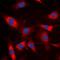 Neutrophil Cytosolic Factor 1 antibody, LS-C368438, Lifespan Biosciences, Immunofluorescence image 