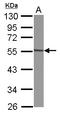 Glycosyltransferase Like Domain Containing 1 antibody, LS-C155679, Lifespan Biosciences, Western Blot image 