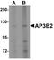 Adaptor Related Protein Complex 3 Subunit Beta 2 antibody, PA5-21163, Invitrogen Antibodies, Western Blot image 