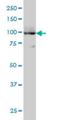 ATPase Sarcoplasmic/Endoplasmic Reticulum Ca2+ Transporting 3 antibody, H00000489-M01, Novus Biologicals, Western Blot image 