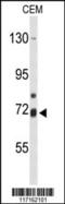 Arachidonate 15-Lipoxygenase Type B antibody, 63-834, ProSci, Western Blot image 