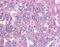 Baculoviral IAP Repeat Containing 5 antibody, GTX24470, GeneTex, Immunohistochemistry paraffin image 