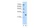 Forkhead Box R2 antibody, PA5-42252, Invitrogen Antibodies, Western Blot image 