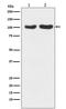 Glutamate Ionotropic Receptor AMPA Type Subunit 2 antibody, M02905-2, Boster Biological Technology, Western Blot image 