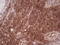 PYM Homolog 1, Exon Junction Complex Associated Factor antibody, LS-C339949, Lifespan Biosciences, Immunohistochemistry paraffin image 