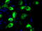 Protein-lysine 6-oxidase antibody, LS-C114933, Lifespan Biosciences, Immunofluorescence image 