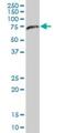 NEDD8 Activating Enzyme E1 Subunit 1 antibody, H00008883-B01P, Novus Biologicals, Western Blot image 