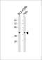 Twinfilin Actin Binding Protein 1 antibody, M07004, Boster Biological Technology, Western Blot image 