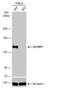 Valosin Containing Protein Interacting Protein 1 antibody, NBP1-32663, Novus Biologicals, Western Blot image 