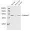 Cholinergic Receptor Nicotinic Alpha 7 Subunit antibody, LS-C203148, Lifespan Biosciences, Western Blot image 
