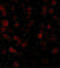 CASP2 And RIPK1 Domain Containing Adaptor With Death Domain antibody, GTX28426, GeneTex, Immunocytochemistry image 
