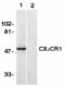 C-X3-C Motif Chemokine Receptor 1 antibody, AHP1589, Bio-Rad (formerly AbD Serotec) , Immunohistochemistry paraffin image 