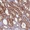GEN1 Holliday Junction 5' Flap Endonuclease antibody, NBP2-30836, Novus Biologicals, Immunohistochemistry paraffin image 