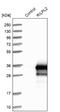 Rab Interacting Lysosomal Protein Like 2 antibody, NBP1-82041, Novus Biologicals, Western Blot image 