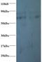 Prefoldin Subunit 5 antibody, LS-C210858, Lifespan Biosciences, Western Blot image 