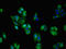 Neurotrophic Receptor Tyrosine Kinase 1 antibody, LS-C671889, Lifespan Biosciences, Immunofluorescence image 