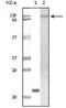 Tyrosine Kinase 2 antibody, MA5-15303, Invitrogen Antibodies, Western Blot image 