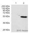 Nuclear Receptor Subfamily 1 Group H Member 3 antibody, ab41902, Abcam, Western Blot image 