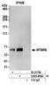 Myotubularin Related Protein 6 antibody, A305-496A, Bethyl Labs, Immunoprecipitation image 