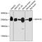 Myosin Heavy Chain 10 antibody, GTX64520, GeneTex, Western Blot image 