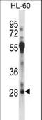 Regulatory Factor X Associated Protein antibody, LS-C162563, Lifespan Biosciences, Western Blot image 