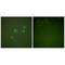 Cyclin E1 antibody, A00543-1, Boster Biological Technology, Immunohistochemistry paraffin image 
