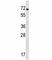 NADPH Oxidase 1 antibody, F45413-0.4ML, NSJ Bioreagents, Western Blot image 