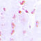 BCL2 antibody, GTX55105, GeneTex, Immunohistochemistry paraffin image 