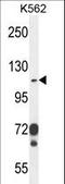 Integrin Subunit Alpha E antibody, LS-C165319, Lifespan Biosciences, Western Blot image 