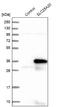 mCAC antibody, NBP1-86689, Novus Biologicals, Western Blot image 