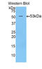 Transglutaminase 1 antibody, LS-C296772, Lifespan Biosciences, Western Blot image 