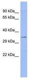 Aspartate Beta-Hydroxylase antibody, TA337291, Origene, Western Blot image 